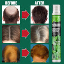 Spray Hair Maximum™ - Crescimento Capilar 10x mais Rápido - So&Pe Store